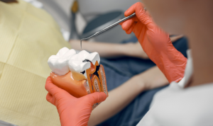 Nha sĩ sử dụng X-quang để phát hiện sâu răng không đau sớm.