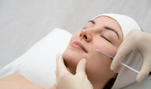 Ứng dụng trong thẩm mỹ theo xu hướng "Natural Look":