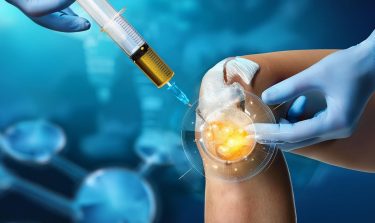 Khi nào nên Tiêm khớp PRP và HA: Hướng dẫn chuyên sâu cho người bệnh xương khớp