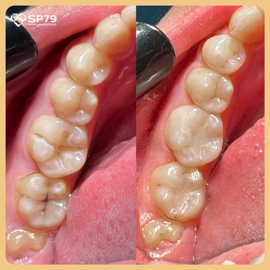 Khi nào cần gặp bác sĩ? Quy trình xử lý tại nha khoa