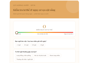 kiểm tra tư thế và nguy cơ vẹo cột sống sp79